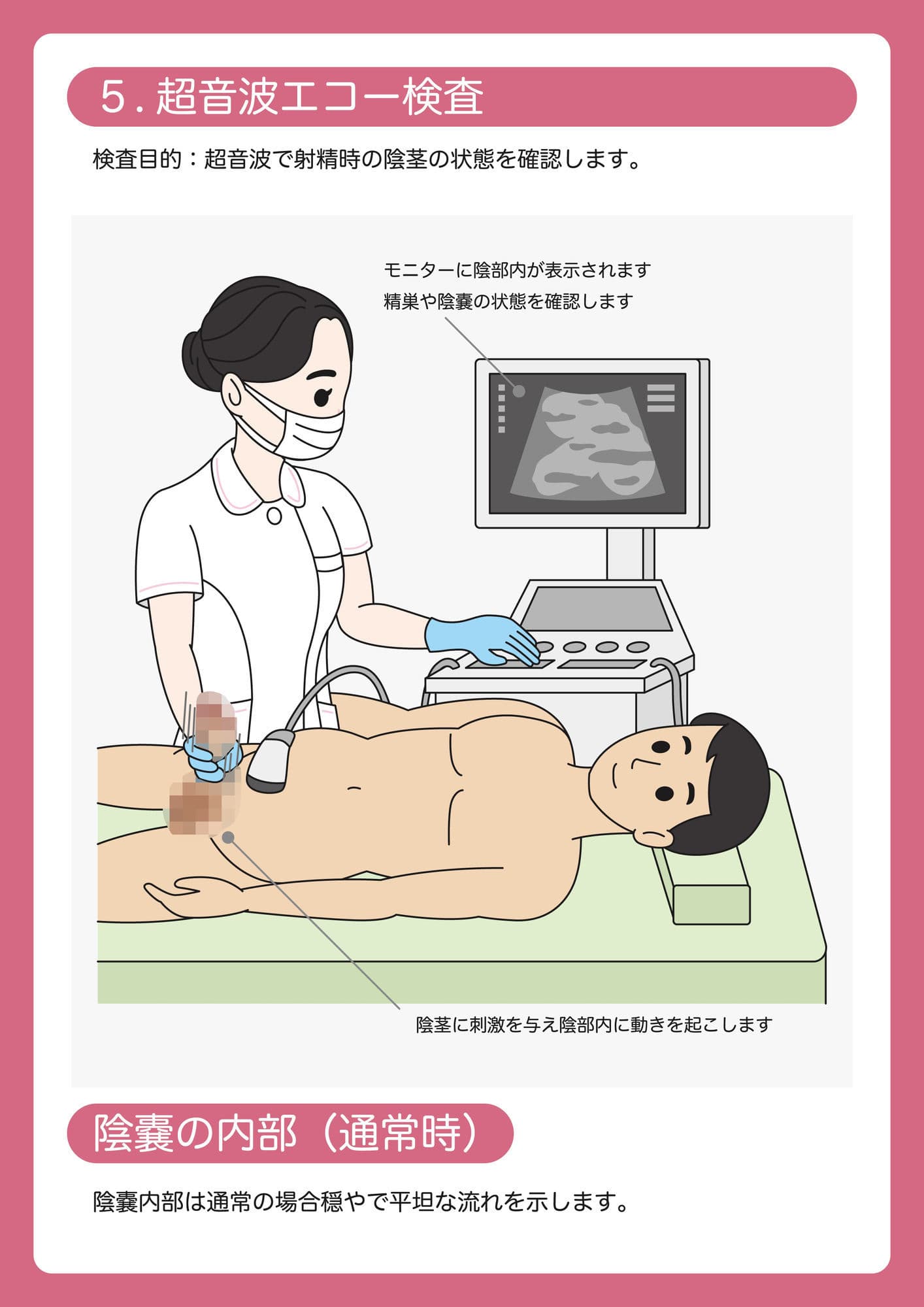 陰茎健診のご案内 サンプル6