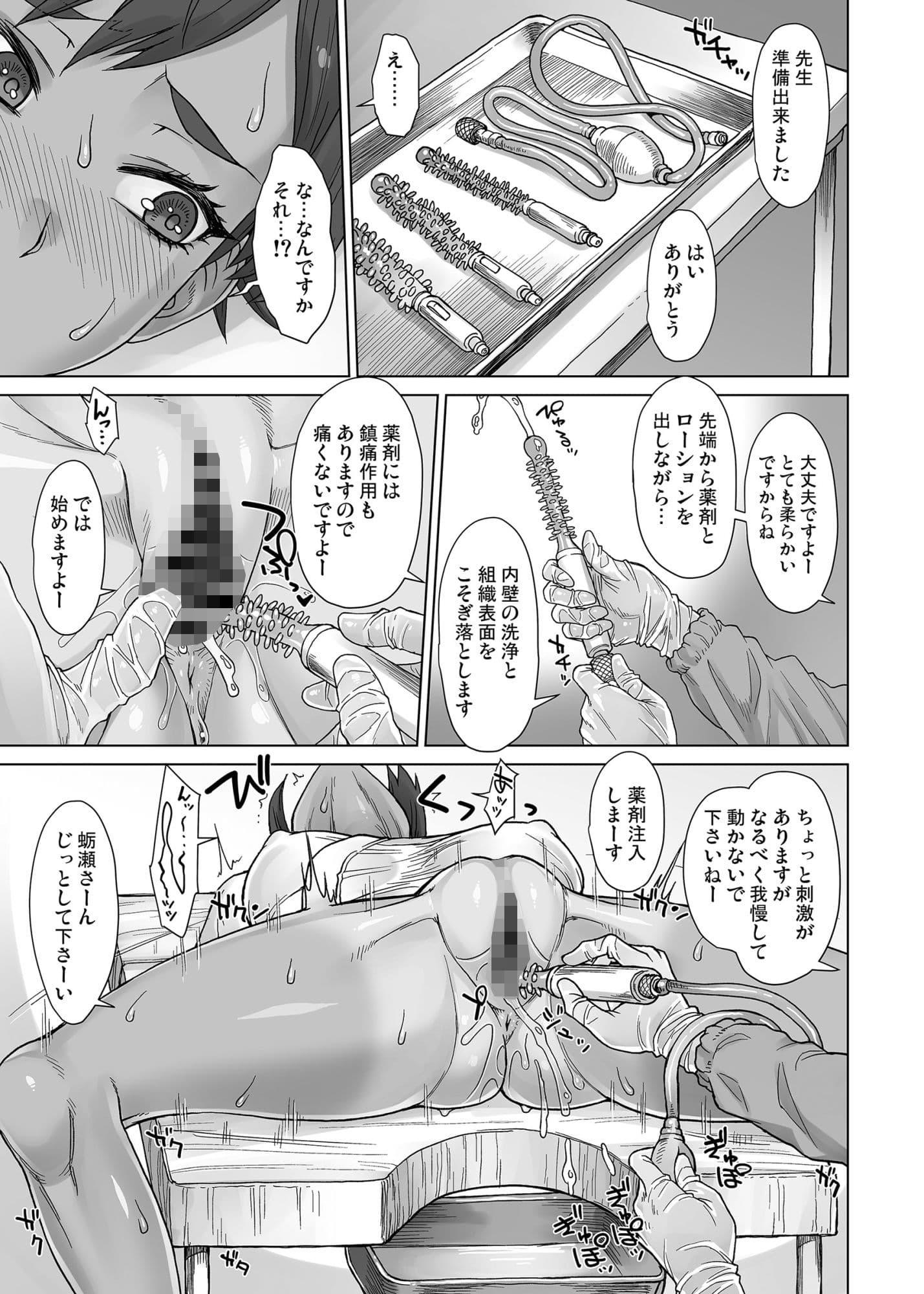 陰部特殊洗浄医院オマクリ サンプル3